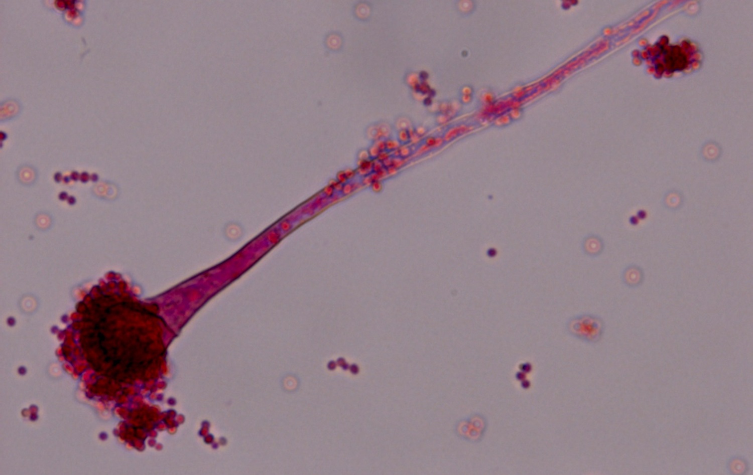 Imagen coloreada al microscopio del hongo 'Aspergillus fumigatus'.