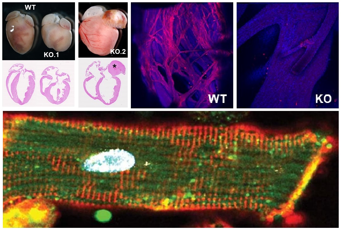 La parte inferior de la imagen es un cardiomiocito, célula cardiaca encargadas de llevar a cabo la función de contracción del corazón. Arriba, figura explicativa del estudio: la imagen a) muestra imágenes de corazones de ratones silvestres (WT) y condicionalmente deficientes para Dhx36 (KO.1) a un mes de vida (arriba), junto a secciones de los mismos corazones (abajo). La imagen b), el corazón de un ratón deficiente para Dhx36 (KO.2) de 4 meses, que presenta miocardiopatía dilatada y un trombo ocupando la aurícula izquierda (marcado con un asterisco). La imagen C) muestra secciones de corazones WT y KO, teñidos en rojo con un marcador de fibras de Purkinje en el ventrículo izquierdo del WT y su ausencia en el KO.