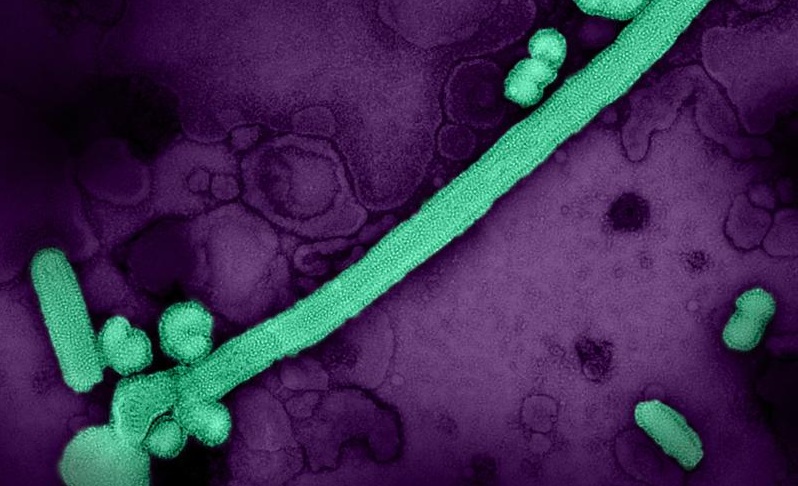 Micrografía electrónica coloreada con partículas del virus influenza A H3N2 (NIAID-NIH).