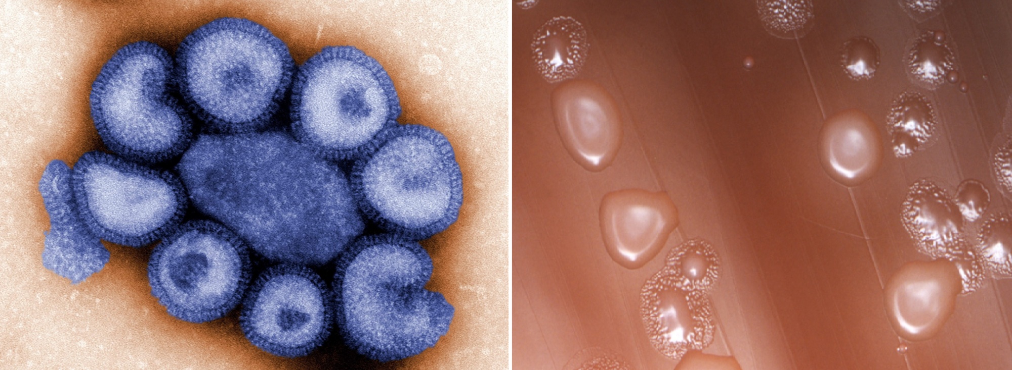 Imágenes al microscopio del virus de la gripe y de la bacteria causante de la neumonía.