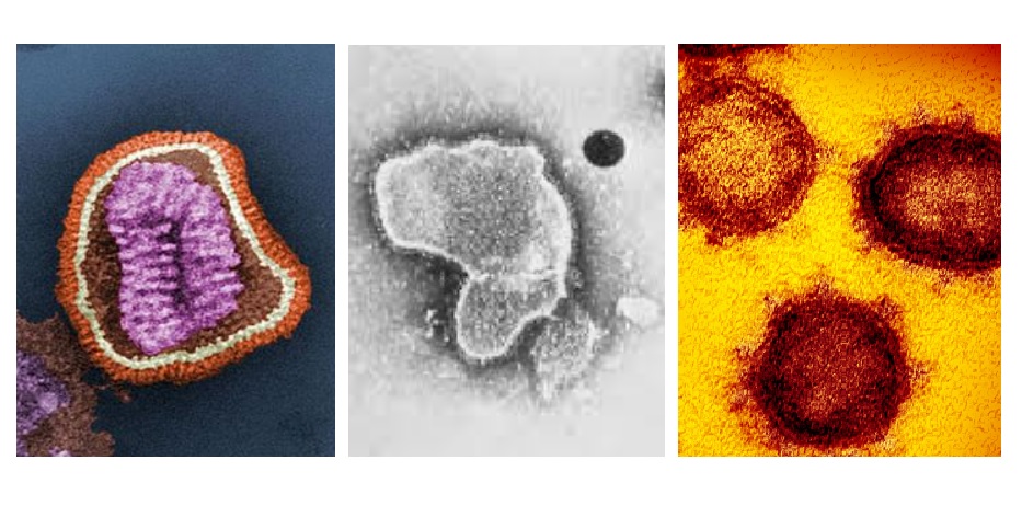 Imágenes al microscopio de los virus de la gripe, VRS y SARS-VoV-2.